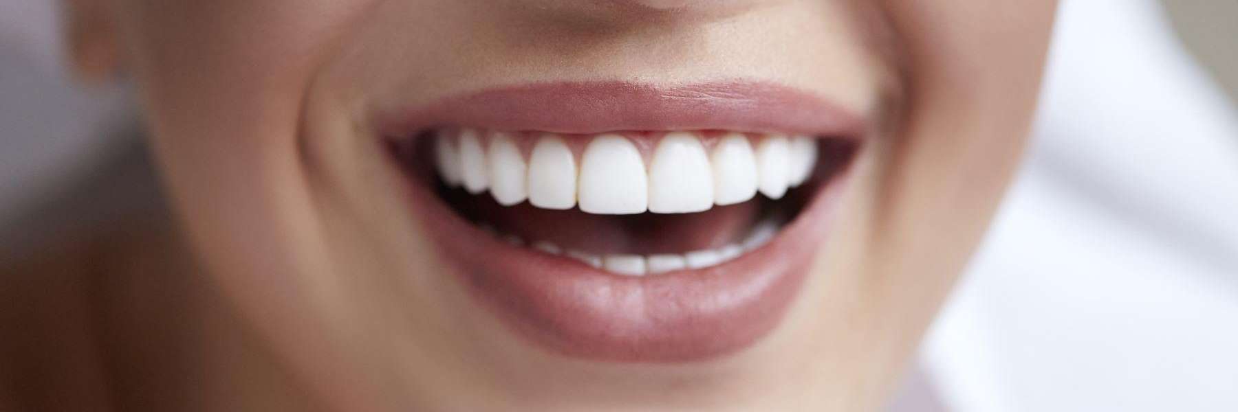cosmetic dentistry blacktown nsw