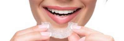 Invisalign Blacktown NSW