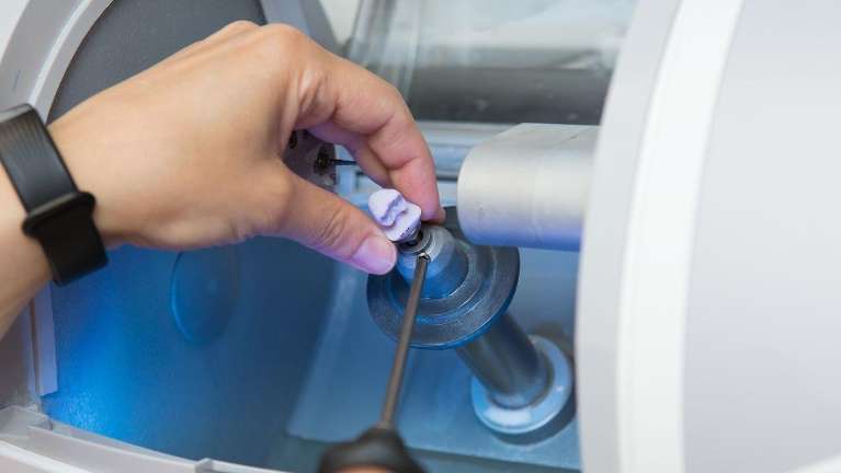 CEREC same-day crown in Blacktown NSW