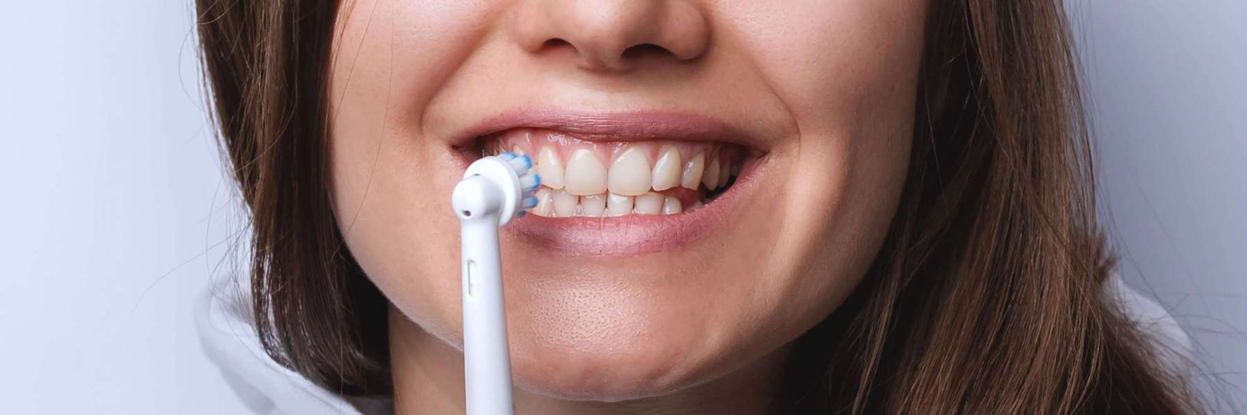 Bright white smile after Zoom whitening Blacktown